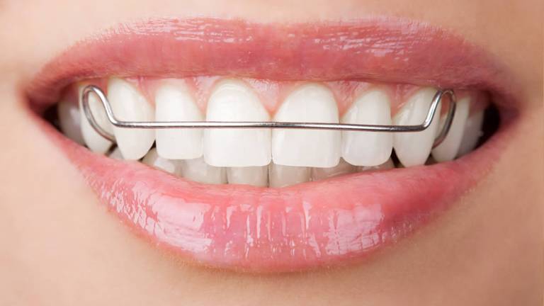 Retainers